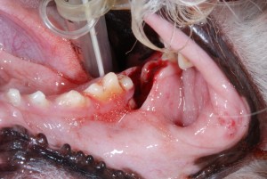 Mandibular Fracture1